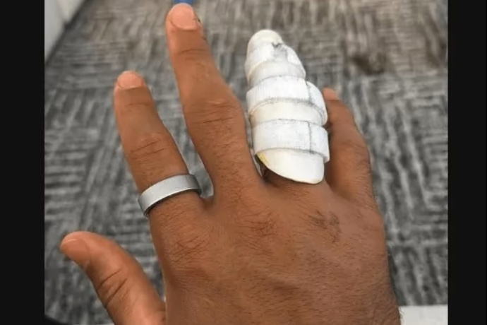 哈特晒术后无名指护具照,湖人后卫线恢复进程引关注 哈特晒术后无名指护具照,湖人后卫线恢复进程引关注